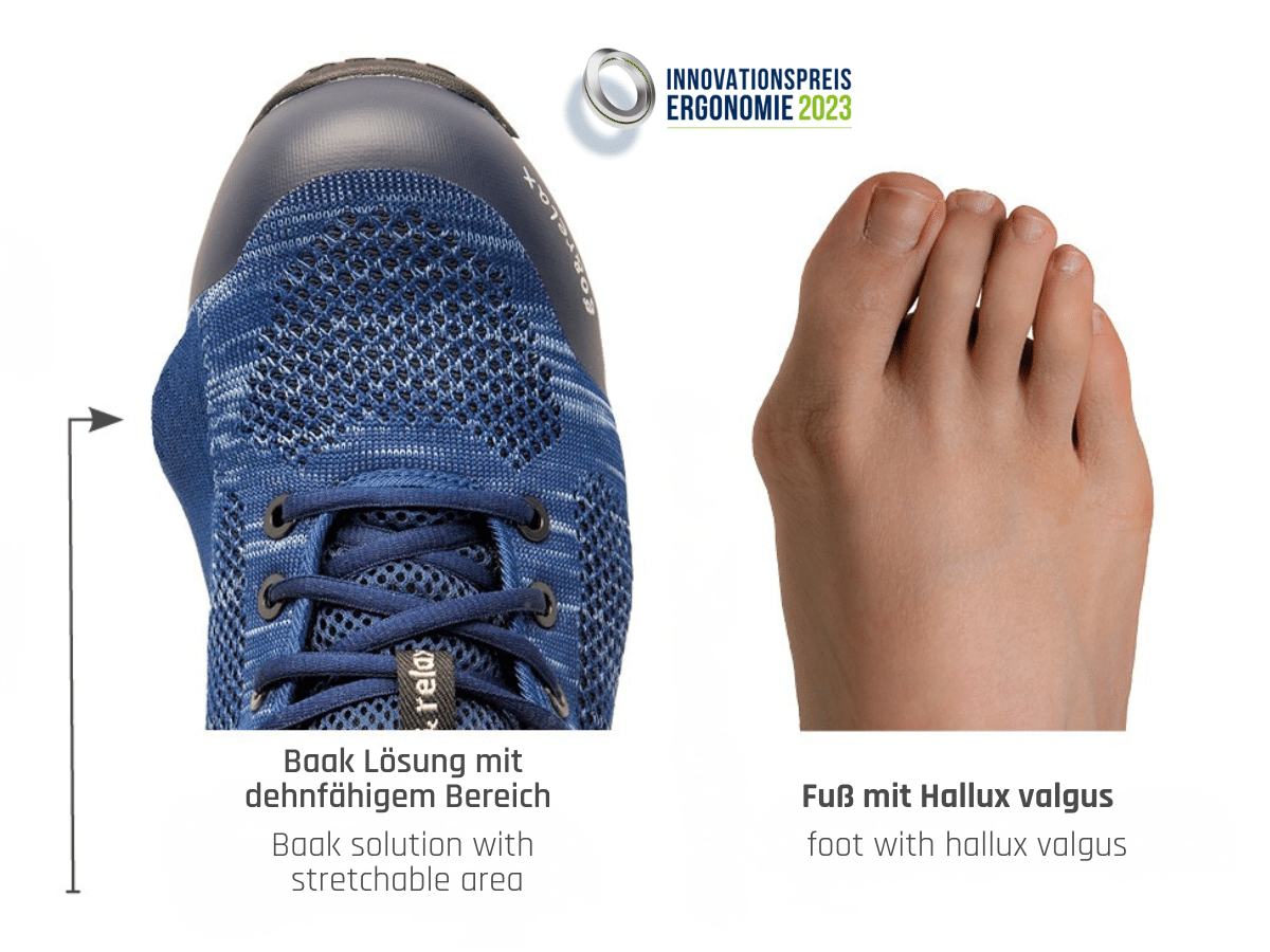 Top view of the right shoe with a bulging forefoot area, and next to it, a right foot with hallux valgus—Hallux Valgus Model Sky